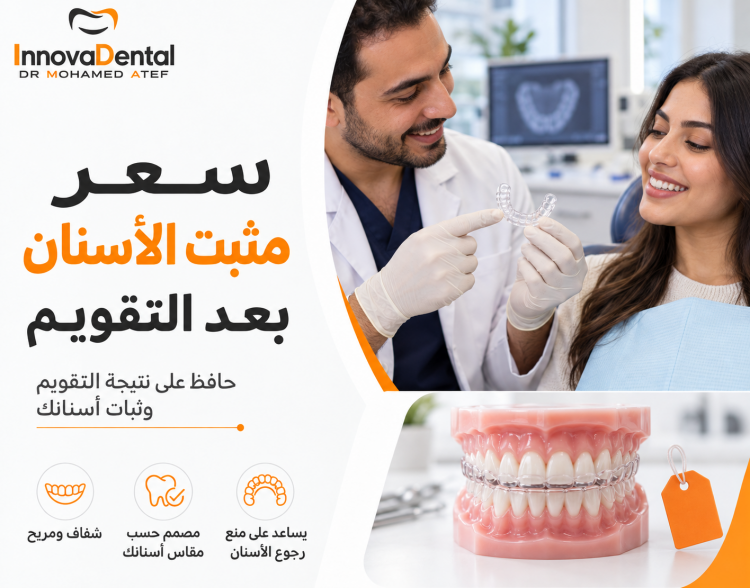 Teeth Retainer Price: Costs & Best Options